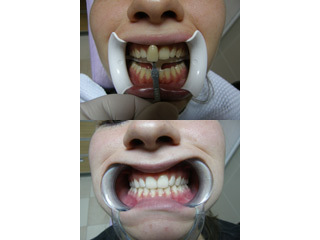 SPECIALIST DENTAL CLINIC OLUSKI - ILIC Novi Sad - Photo 4