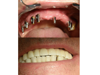 SPECIALIST DENTAL CLINIC OLUSKI - ILIC Novi Sad - Photo 5