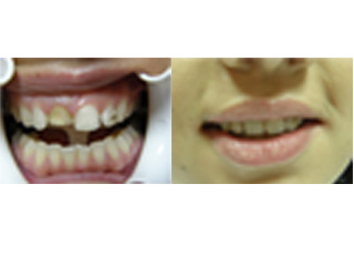 SPECIALIST DENTAL CLINIC OLUSKI - ILIC Novi Sad - Photo 7